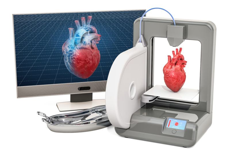A 3D printer building a heart model beside a monitor showing the digital scan it was made from