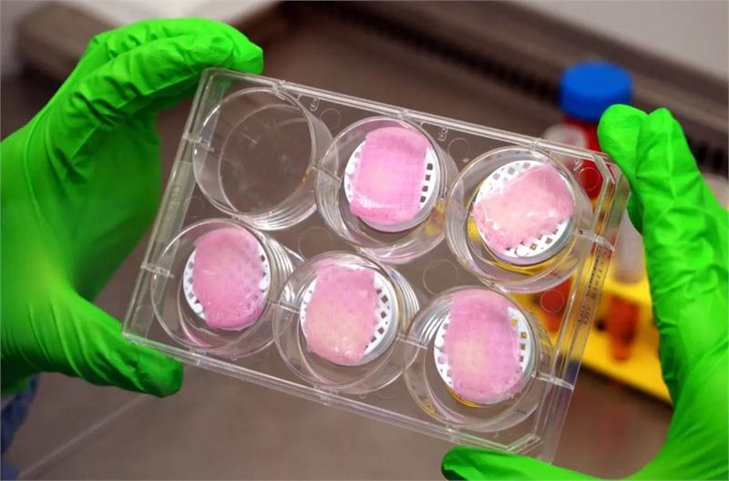 Gloved hands holding a six-well culture plate containing discs of laboratory-grown human skin